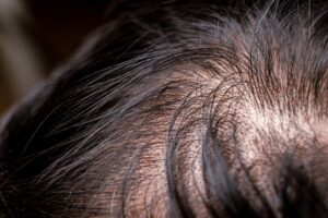 understanding hair growth cycles