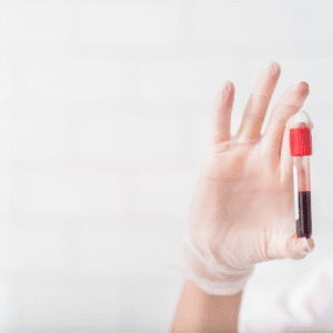 Hypothyroidism Treatment